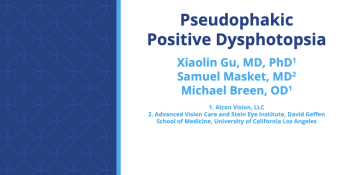 Pseudophakic Positive Dysphotopsia