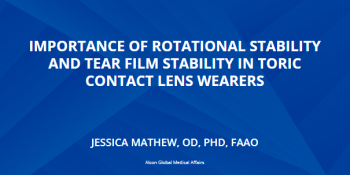  Importance Of Rotational Stability And Tear Film Stability In Toric Contact Lens Wearers